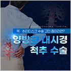 양방향 내시경 척추 수술