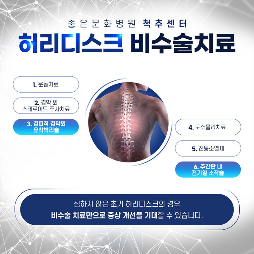 허리 디스크 치료1