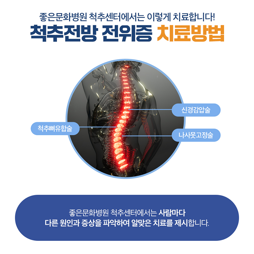 척추전방 전위증2