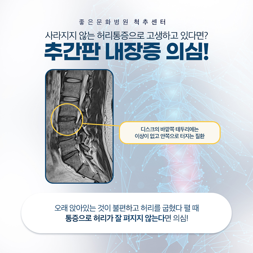 추간판 내장증1