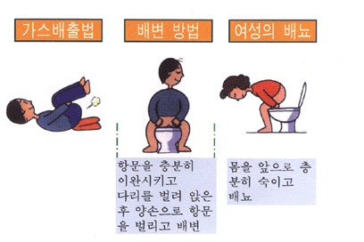 가스배출법, 배변방법:항문을 충분히 이완시키고 다리를 벌려 앉은 후 양손으로 항문을 벌리고 배변, 여성의 배뇨:몸을 앞으로 충분히 숙이고 배뇨