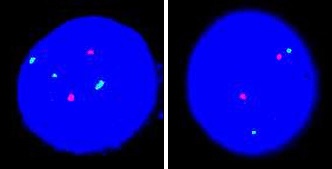 FISH (Fluorescence In Situ Hybridization) 